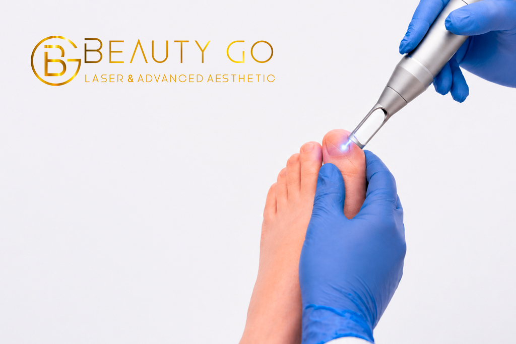 Cómo eliminar hongos en las uñas de forma eficaz - Beautygo Clinics