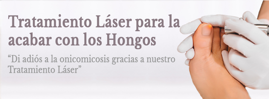 Tratamiento Láser para acabar con la Onicomicosis en Barcelona - Beautygo Clinics