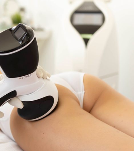 Tratamiento de Radiofrecuencia VForm de Viora en Barcelona - Beautygo Clinics